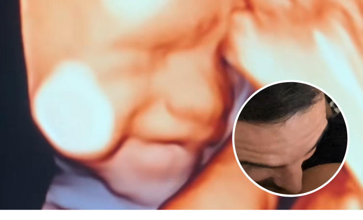 Imagen de la noticia: ”Ríete para la foto”: Bebé sorprende con tierna sonrisa tras escuchar a su padre en una ecografía
