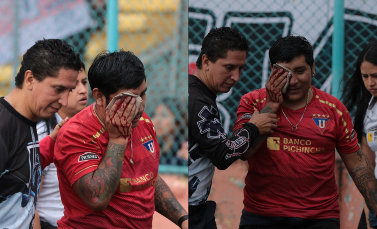 Imagen de la noticia: Hincha de Liga de Quito pierde un ojo tras recibir disparo de bala de goma en partido de LigaPro