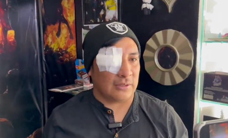 Imagen de la noticia: Hincha de Liga de Quito que perdió el ojo exige justicia: “Estoy completamente sin un ojo”  