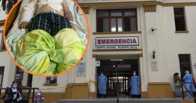Imagen de la noticia: Joven es quemado por su amigo tras negarse a seguir bebiendo en Perú