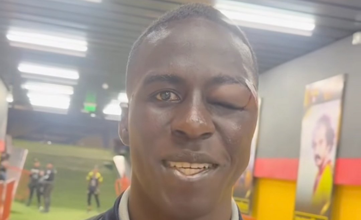 Jugador de Liga de Quito fue operado con éxito tras sufrir fractura facial