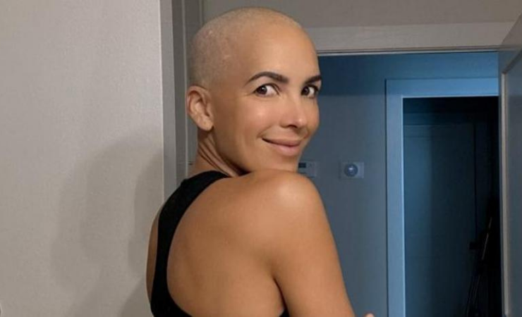 María Teresa Guerrero:  “No voy a negar que me duele no tener mi pelo”