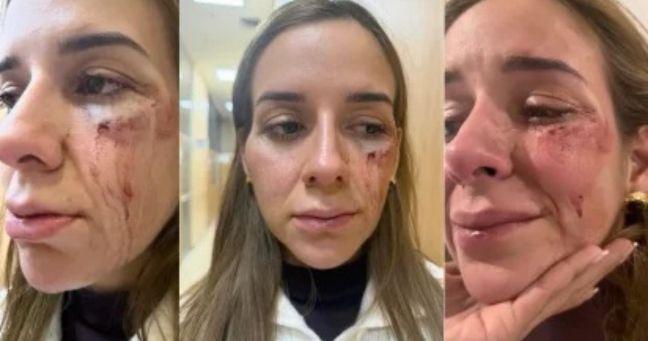 Scarlett Córdova denuncia agresión de expareja