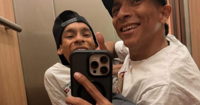 Familia de los siameses del Ecuador pide privacidad
