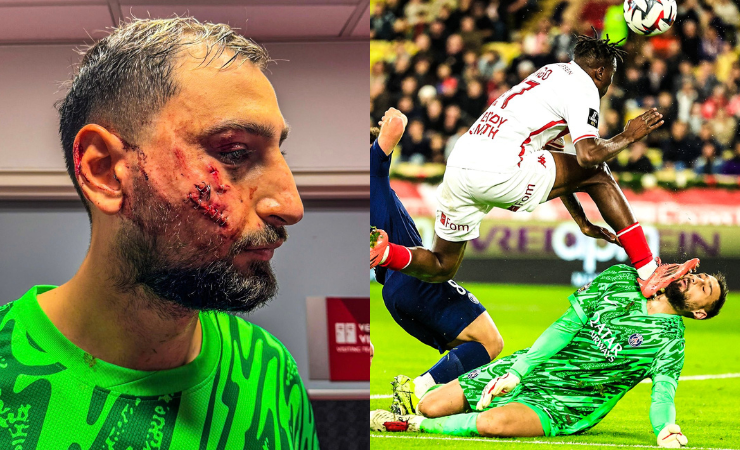 «Casi le arranca la cabeza»: Así quedó el rostro de Donnarumma tras una escalofriante patada