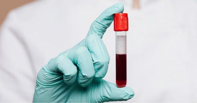 Imagen de la noticia: Revolución médica: científicos japoneses crean sangre artificial compatible con todos los grupos
