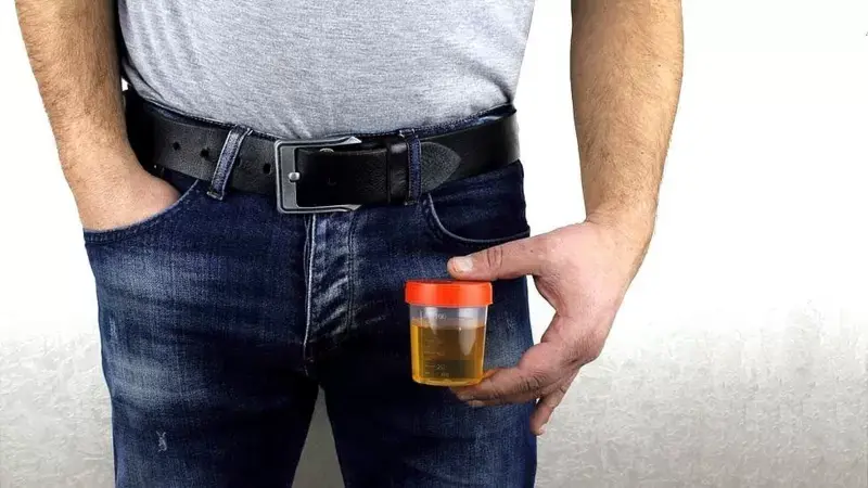 Imagen de la noticia: El revolucionario hallazgo que vincula el cáncer de próstata con bacterias en la orina