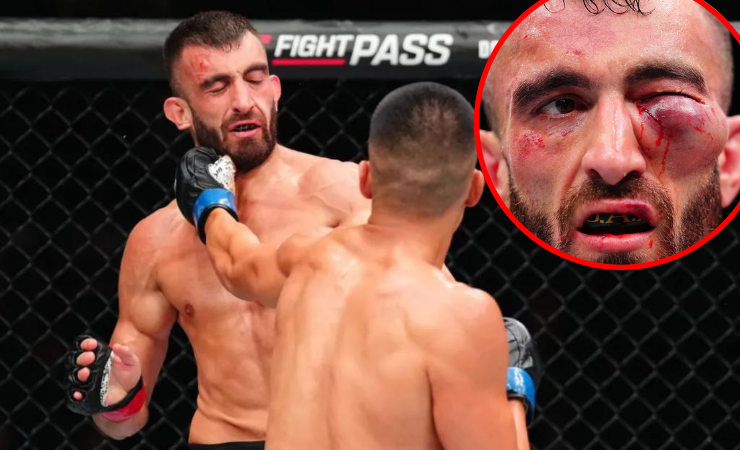 Imagen de la noticia: Luchador de la UFC sufrió una escalofriante lesión en el ojo: médicos pararon el combate