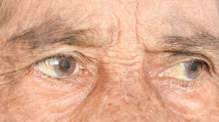 Así es la prótesis ocular con la que personas con ceguera irreversible podrían leer nuevamente